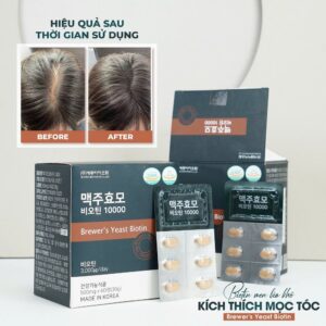 Viên mọc tóc Hàn Quốc Brewer’s Yeast Biotin